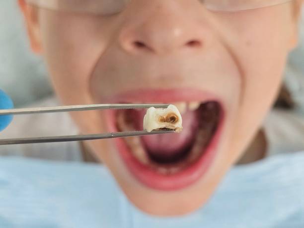 Best Emergency Denture Repair in Wamac, IL